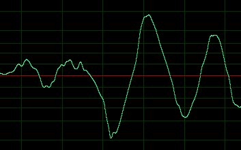 A sound wave plotted as a graph showing vibration (y-axis) over time (x-axis).